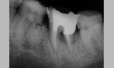 Dental clinic in Anand
                        